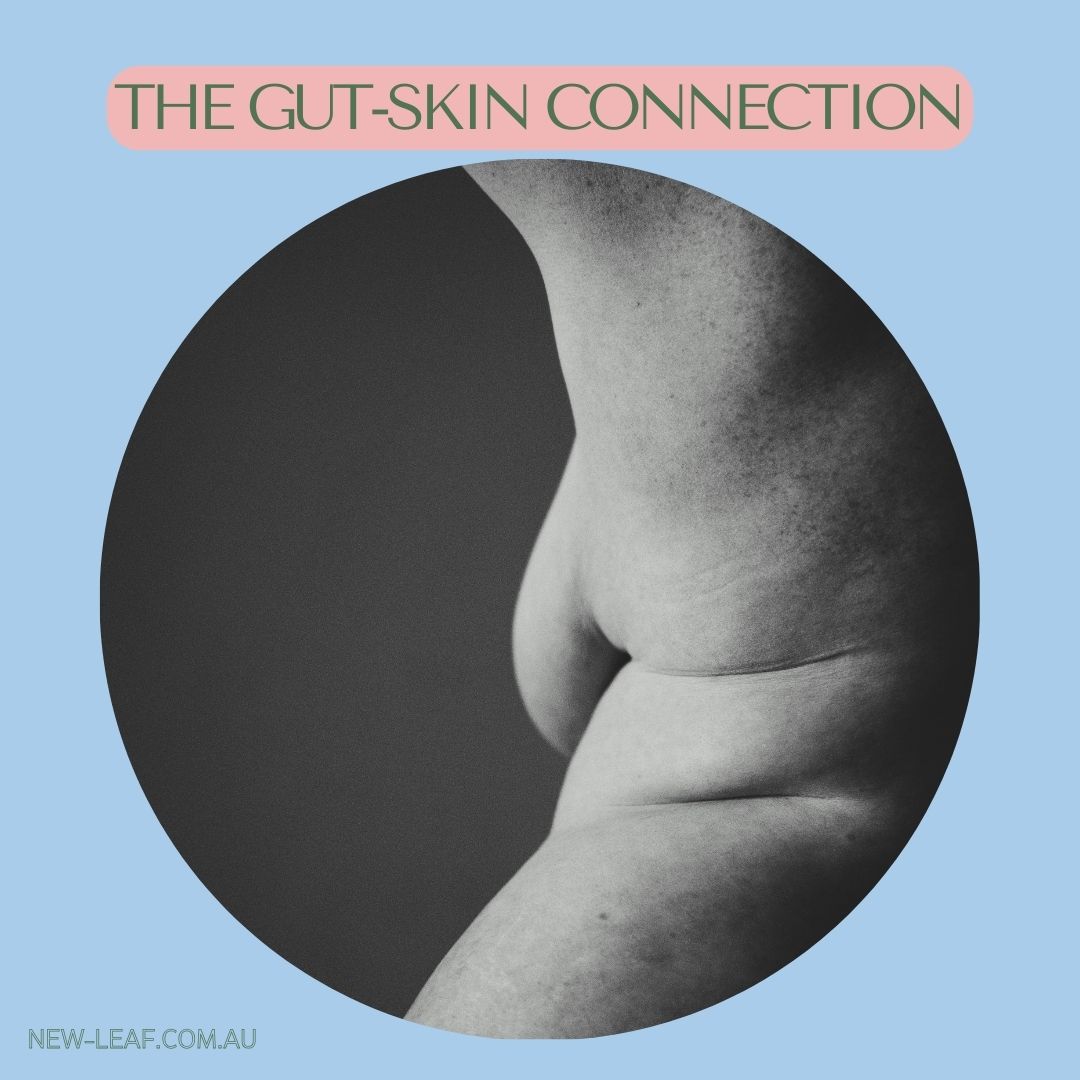 the link between your gut and your skin - how can gut health influence your skin with acne eczema and redness.